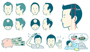 育毛サイト 記事イラスト